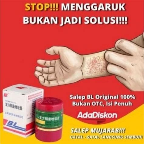 Jual Salep Obat Kulit Gatal Selangkangan Alergi Kulit Kadas Kurap Eksim