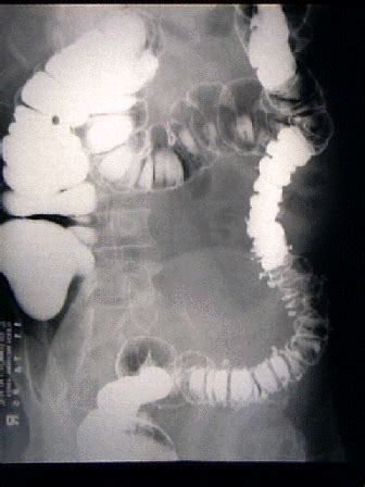 Dms Fluoroscopy Flashcards Quizlet