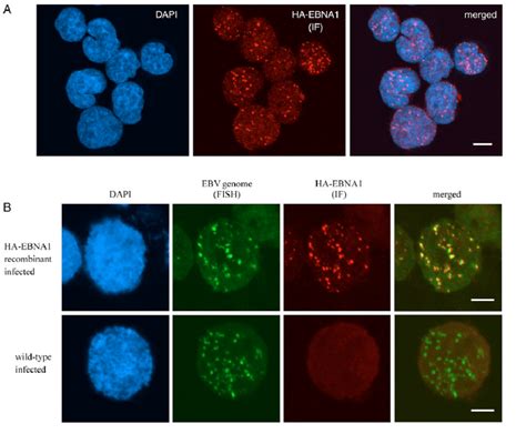 Subnuclear Localization Of Ha Tagged Ebna Protein A Cells Were