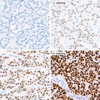 Representative Immunohistochemical Images Showing The Different Otp