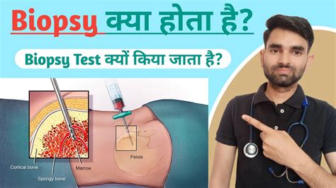 Biopsy Test Kaise Hota Hai Biopsy Kya Hota Hai Biopsy Test In Hindi