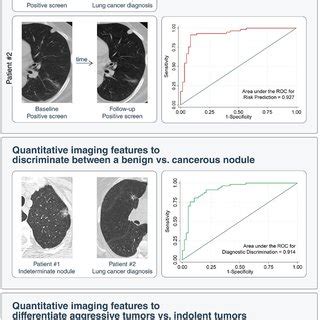 Potential Enhanced Clinical Workflow With Artificial Intelligence Ai