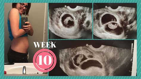 IVF PREGNANCY #2: WEEK 10 + ULTRASOUND PICS!!! - YouTube