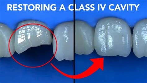 Class Iv Restoration With G Aenial A Chord Youtube