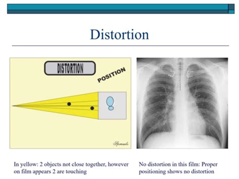 Medical Imaging Intro The Chest X Ray Flashcards Quizlet