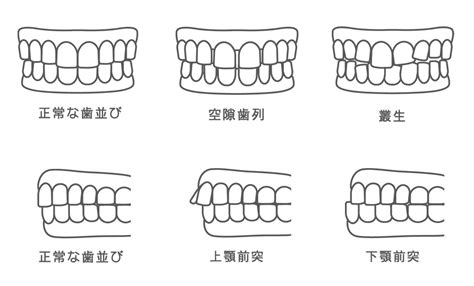 歯ってどんなもの？歯科衛生士が歯の構造や名称を専門的に教えます！ 札幌 西区 宮の沢 さいとう歯科インプラント専門サイト