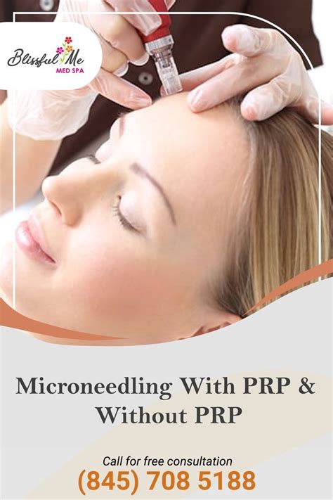 Microneedling With Prp Artofit