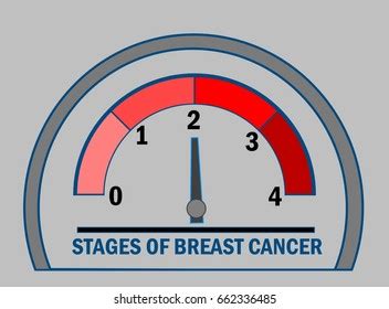 342 Stages Of Breast Cancer Images, Stock Photos & Vectors | Shutterstock