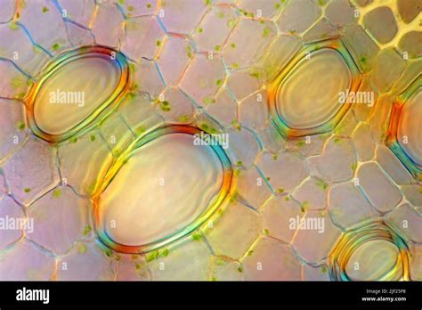 Polarized Light Micrograph Of A Transverse Cross Section Through The