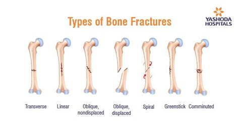 Various Types of Sports Injuries and 7 Tips to Prevent Them | by ...