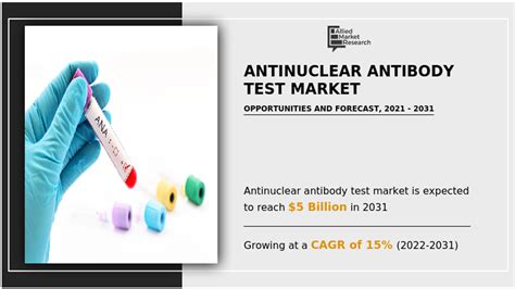 Ppt What Is Antinuclear Antibody Test Powerpoint Presentation Free To Download Id