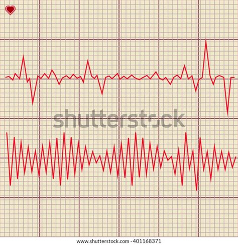 Vector Set Of Various Cardiogram Design Elements