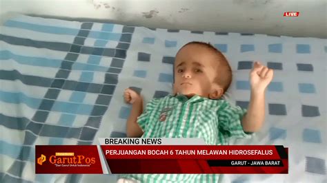 Video Kisah Alfa Muzakir Bocah Penderita Hidrosefalus Di Garut Yang