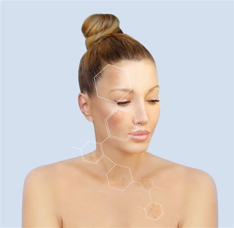 What To Know About The Three Types Of Hyperpigmentation