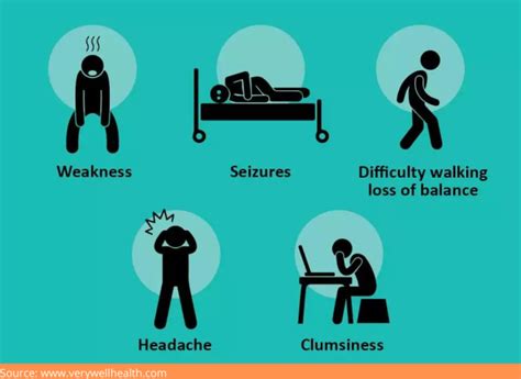 Glioblastoma –Symptoms, Causes, Diagnosis, And The best Treatment - Dr Rao's Hospitals