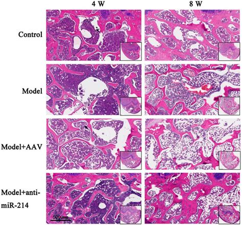 Frontiers Adenovirus Associated Anti Mirna Regulates Bone