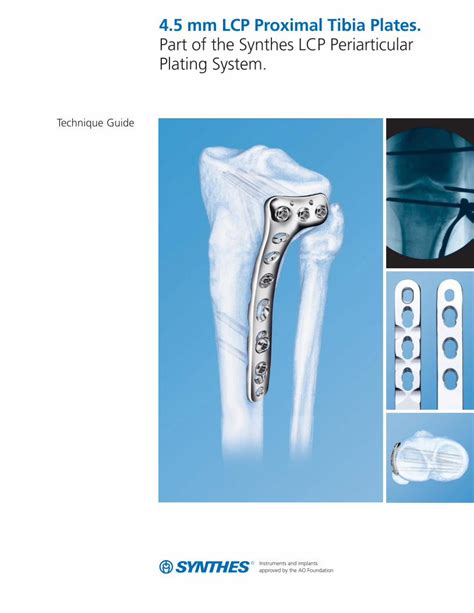 PDF 4 5 Mm LCP Proximal Tibia Plates Part Of The Synthes LCP