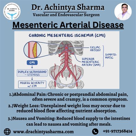 Needs to understand about Mesenteric Artery Disease Symptoms