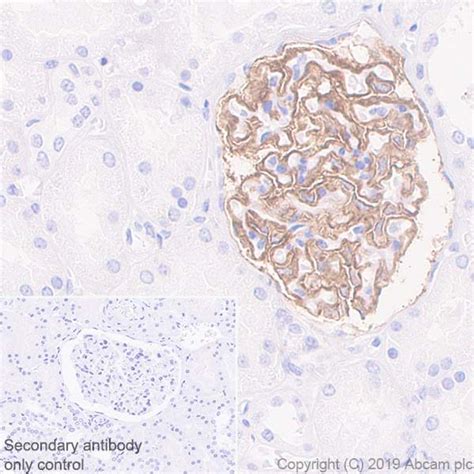 Anti Tissue Factor Antibody Epr Bsa And Azide Free