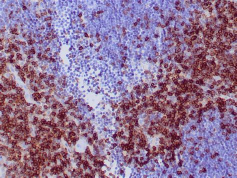 Cd27 Antibody Recombinant Ivd Antibody For Ihc Zeta Corporation