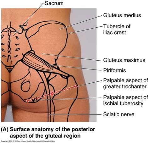 Iliac Tubercle Surface Anatomy