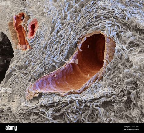 Blood Vessels Coloured Scanning Electron Micrograph Sem Of A Freeze