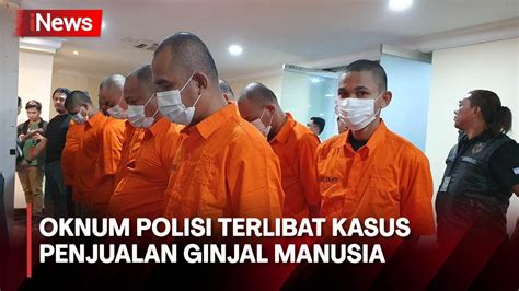 Anggota Polisi Dan Imigrasi Terlibat Sindikat Jual Beli Ginjal