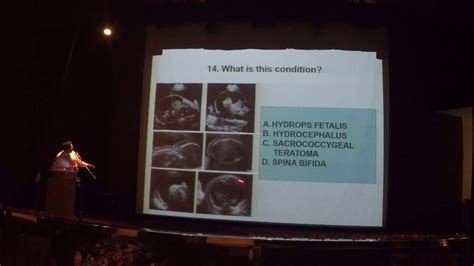 Basic Obstetrics And Gynaecology Ultrasound Quiz Youtube