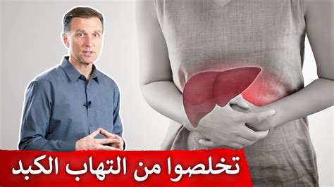 أفضل علاج طبيعي يساعد في التخلص من التهاب الكبد Youtube