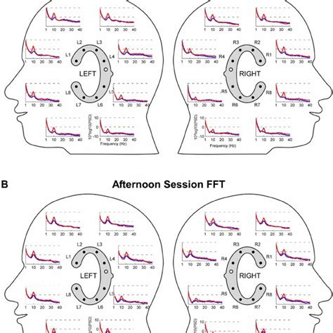 (PDF) Unobtrusive ambulatory EEG using a smartphone and flexible ...