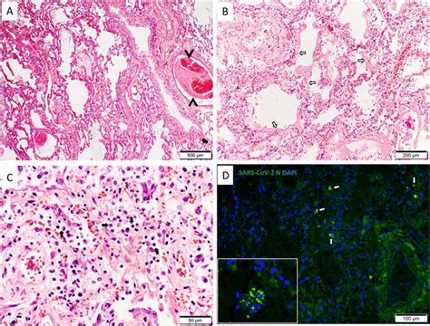 Histology Of Lung Tissue Section A Image Of Hematoxylin And Eosin