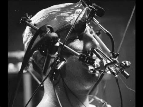 15 Shocking Medical Experiments Performed On Human Beings