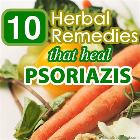 10 Herbal Remedies that Heal Psoriasis #psoriazis #psoriazisremedy | Natural psoriasis remedies ...