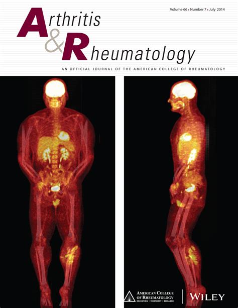 Rheumatoid Arthritis During Pregnancy And Postnatal Catch‐up Growth In