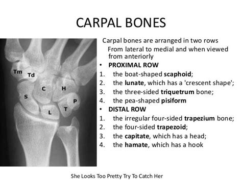 Carpal bone fractures