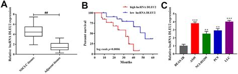 Lncrna Dleu Modulates Cell Proliferation And Invasion Of Non Small