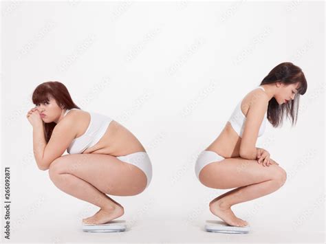 Foto Stock Fat Woman Comparison Before And After Weight Loss Transformation Of The Body