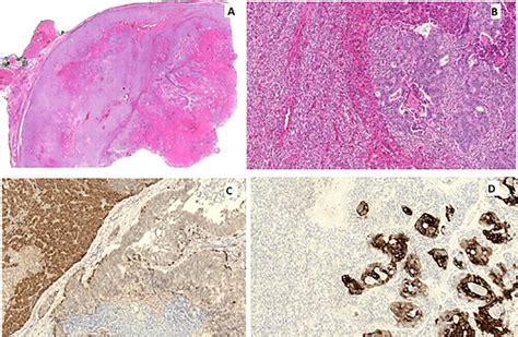 Histopathologic And Immunohistochemical Staining Findings Of Thyroid Download Scientific