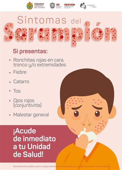 Síntomas del Sarampión Infografías SaludVeracruz