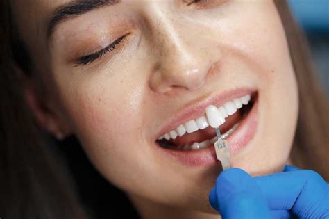 Cuánto Dura un Blanqueamiento Dental Paz Salvador Dental