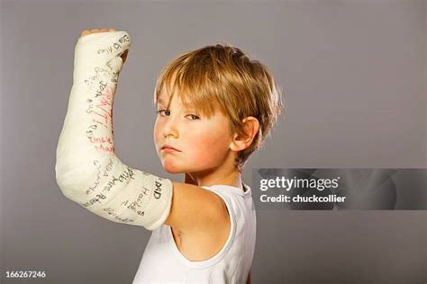 Boy Cast On Arm Photos And Premium High Res Pictures Getty Images