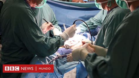 La Pionera Cirugía Para Operar El Cáncer De Páncreas Uno De Los Más Letales Bbc News Mundo