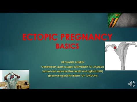 ECTOPIC PREGNANCY DIAGNOSIS AND MANAGEMENT BASICS YouTube