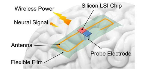 Flexible Implant Wirelessly Supplies Power To The Brain Medical