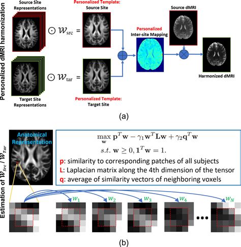 Human Brain Mapping Neuroimaging Journal Wiley Online Library