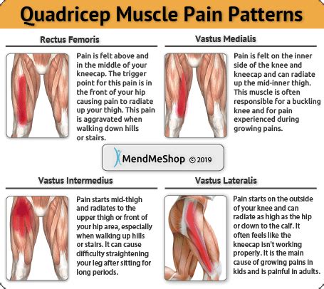 Quadriceps Tendonitis