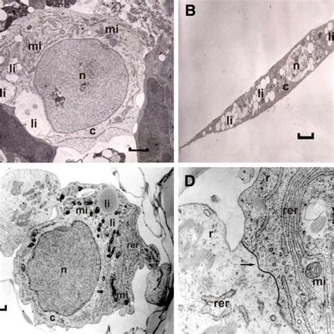 Electron Micrographs Of A Bovine Granulosa Cells Electron Micrographs