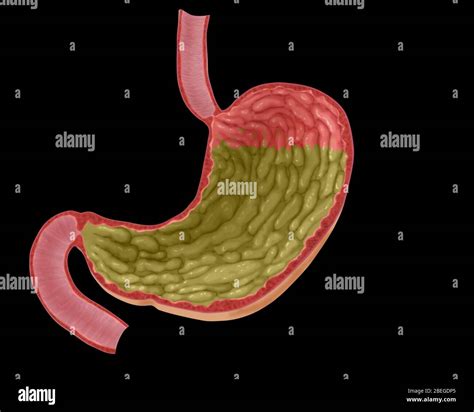 Full Stomach Diagram