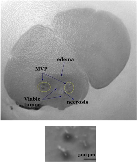 A Selected Tumor Slice Of 2d Reconstructed Dei Images Shows Contrast