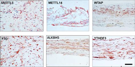 Expression Of M6a Writers Mettl3 Mettl14 And Wtap Erasers Fto And Download Scientific